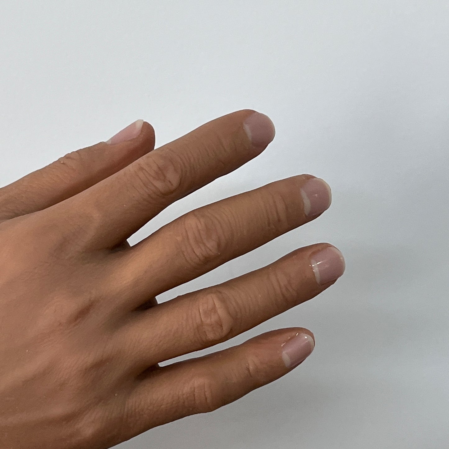 Customized Palm Prosthesis - Blackish