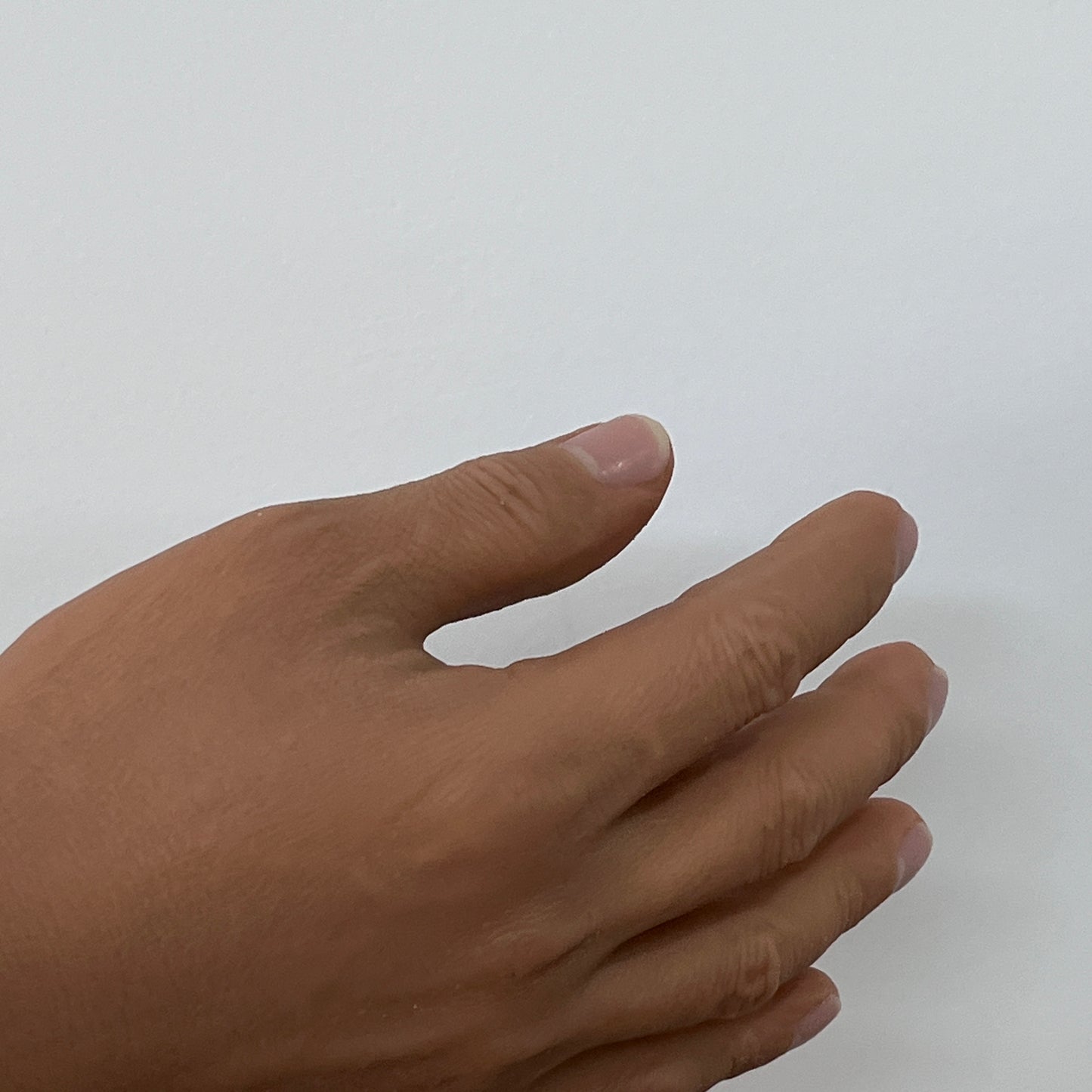 Customized Palm Prosthesis - Blackish