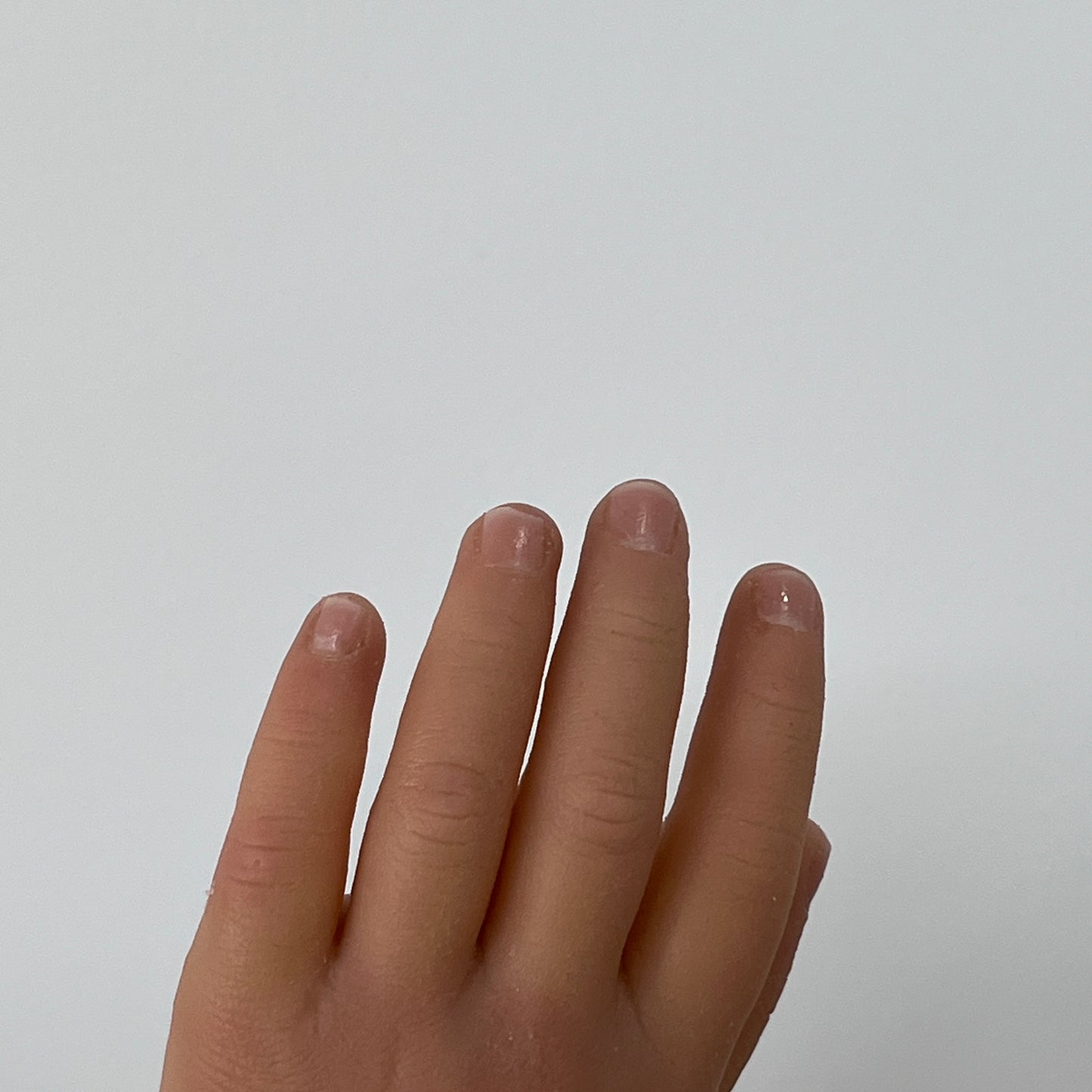 Customized Palm Prostheses - Rounded